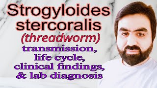 Lec27  Strogyloides stercoralis  Threadworm  clinical findings  lab diagnosis  UrduHindi [upl. by Aicined]