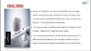 EBUS Bronchoscopy I Dr Jaykumar Mehta [upl. by Margot]