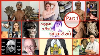 અજીબોગરીબ મેડીકલ બીમારીઓ  પાર્ટ ૧ Rare  Weird  Bizzare  strange  Mind Boggling Medical Diseases [upl. by Aseena]