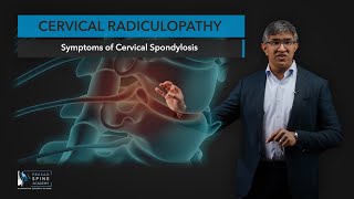 What is Cervical Radiculopathy [upl. by Nebra]