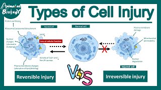 Reversible vs irreversible cell injury  Cell injury  Pathology  USMLE [upl. by Llehsim]