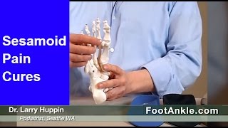 What are the Best Treatments for Sesamoiditis with Seattle Podiatrist Dr Larry Huppin [upl. by Wendel]