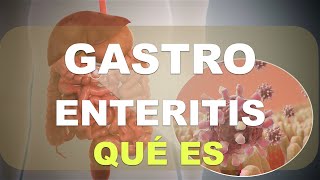 ¿Qué es la Gastroenteritis Explicación [upl. by Ellecrad964]