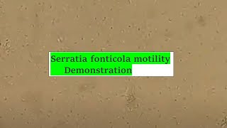 Serratia fonticola motility [upl. by Nivrek]