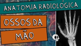 Anatomia radiológica RX dos MEMBROS SUPERIORES Parte 25  MÃO  METACARPOS E FALANGES [upl. by Tjader]