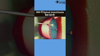 Spinal Anesthesia  How spinal is given  Epidural Anesthesia rirssurgery pregenency [upl. by Drageruaeb]