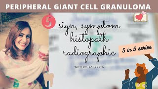 peripheral giant cell granuloma [upl. by Htepsle816]