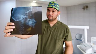 LA RADIOGRAFÍA MÁS IMPORTANTE DE TU TRATAMIENTO DE ORTODONCIA 🔥 ¿DIENTES VOLADOS CON BRACKETS [upl. by Dora]