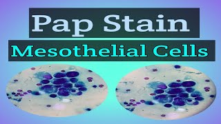 Pap Stain  Staining  Cytology  Mesothelial Cells  E Learn with Technologist [upl. by Inalem178]