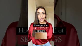 How to get rid of skin tags with pcos [upl. by Hcirteid111]