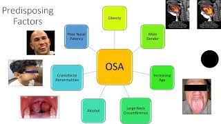 Obstructive Sleep Apnea for beginners [upl. by Amsirp]