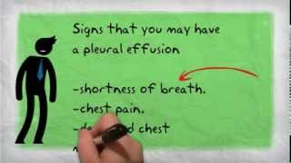 Pleural Effusion [upl. by Cecilla7]