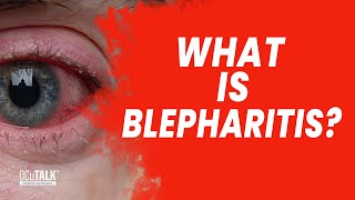 What is blepharitis Areen Hosein OD explains [upl. by Fabyola765]