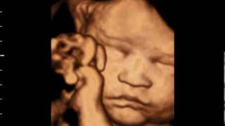 3D ultrasound at 31 weeks GoldenView Ultrasound [upl. by Lleznol]