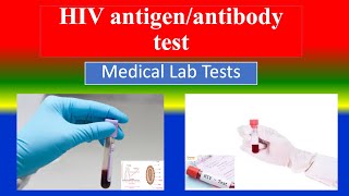 HIV antigenantibody test  Medical Lab Tests  What is   Uses  Need  Preparation  Results [upl. by Frentz]