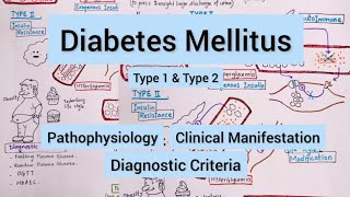 Diabetes Mellitus Type 1 amp Type 2 [upl. by Valdis90]