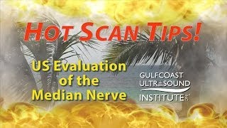 Hot Tips  Ultrasound Evaluation of the Median Nerve [upl. by Woodrow]