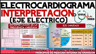 ELECTROCARDIOGRAMA INTERPRETACIÓN  GuiaMed [upl. by Pena]