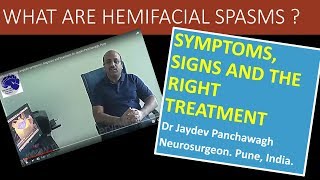 Hemifacial Spasms englishsymptoms diagnosis and treatment Dr Jaydev Panchawagh Pune [upl. by Erastus]