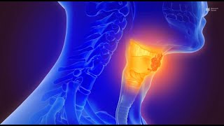 Mechanisms and prospects of HPVinduced oropharyngeal squamous cell carcinoma [upl. by Fowler732]