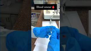 Blood Smear Under microscope 🔬 microscope wbc microbiology ytshorts labtechnician yt biology [upl. by Assenov]