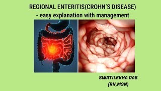 What is Crohns Disease easy explanation with management [upl. by Amalee]