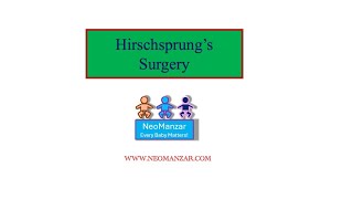 Hirschsprung’s Surgery Newborn Infant [upl. by Joycelin]