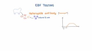 Epstein Barr Virus EBV Diagnosis and Testing [upl. by Sanburn]