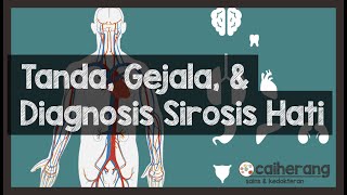 Tanda Gejala dan Diagnosis Sirosis Hati Deteksi Sirosis Hati dan Gagal Hati [upl. by Nylitsirk539]