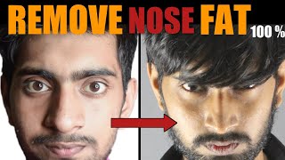 Mote Naak Ko Patla Karne Ka Tarika हिंदी How To REMOVE Nose Fat  100 Slim  Sharp Big Nose [upl. by Aralomo685]