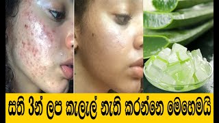 කෝමාරිකා වලින් සුදු වෙන්නෙ මෙහෙමයි  Aloe Vera Ice Cubes for Skin  Komarika treatment sinhala [upl. by Llertnahs]