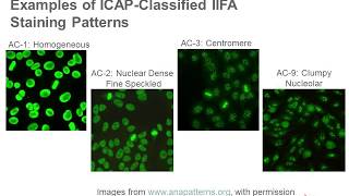 Antinuclear Antibody Testing [upl. by Aleik690]