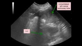 Lung lobe torsion [upl. by Veedis]