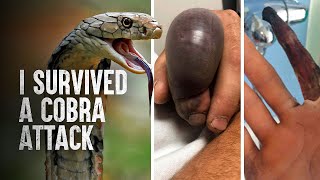 How to Survive a King Cobra Attack [upl. by Anwad969]