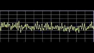 Metabolism Repair  Rife Frequencies [upl. by Attaymik181]