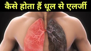 धूल और प्रदूषण में काम करने वालों के साथ क्या होता है। hypersensitivity 3। hypersensitivity 4 [upl. by Fantasia858]