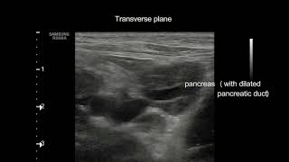 Extrahepatic cholestasis in a cat [upl. by Glynias134]