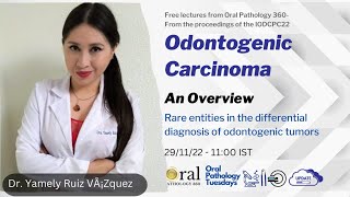 Odontogenic Carcinoma case based Discussion of diagnosis  Oral pathology 360 [upl. by Meagher]