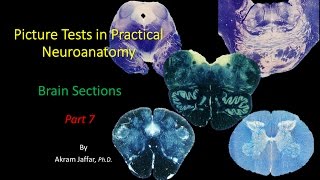 Picture Test in Neuroanatomy Brain Sections 7 [upl. by Caro]