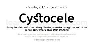 Cystocele pronunciation and definition [upl. by Valerie]