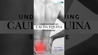 Cauda Equina Syndrome Explained Symptoms Diagnosis and Urgent Treatment [upl. by Airehc]