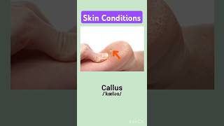 Can you name these Skin conditions  learnenglish dailyenglish vocabulary learn vocabularyquiz [upl. by Sifan]