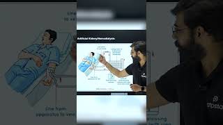 Function of Artificial Kidney  Hemodialysis  Class 10 Biology shorts reels biology [upl. by Yule]