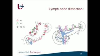 Standards options et recommandations dans le traitement chirurgical du cancer de l’estomac [upl. by Akeme]