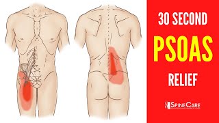 How to Fix a Tight Psoas Muscle in 30 SECONDS [upl. by Agata]