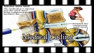 Coding Nerve Block Follow Up  Medical Coding Training [upl. by Haywood799]