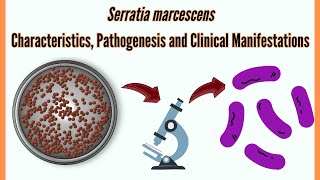 Serratia marcescens Characteristics Pathogenesis amp Clinical Manifestations  Bacteriology Lectures [upl. by Folly941]