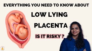 What is low lying placentaAre you worried because your ultrasound shows a low lying placenta [upl. by Nnyllaf92]