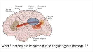 PROSOPAGNOSIA Face blindnessANGULAR GYRUS LESIONS [upl. by Riay180]