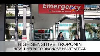 Troponin  the emergency department blood test and what it can show if youve had a heart attack [upl. by Cormick]